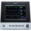 Edan X8 Patient Monitor