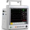 Edan iM70VET Multi-Parameter Veterinary Monitor